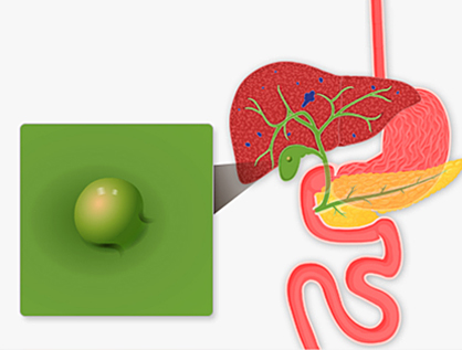 담낭질환